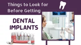 things to look for before getting