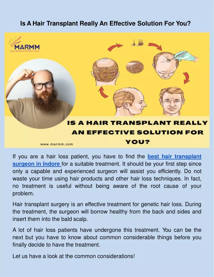 is a hair transplant really an effective solution