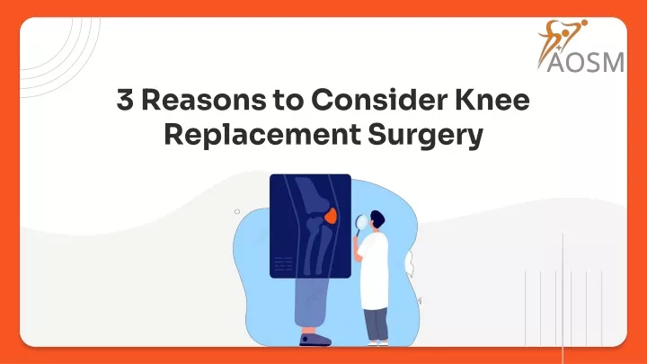 3 reasons to consider knee replacement surgery