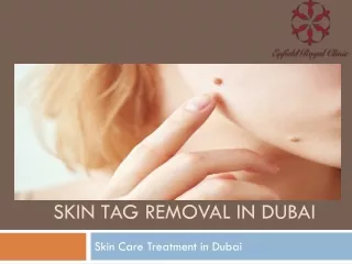 Skin tag Removal In Dubai