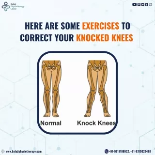 What is Knck knees - Balaji Physiotherapy Clinic Noida