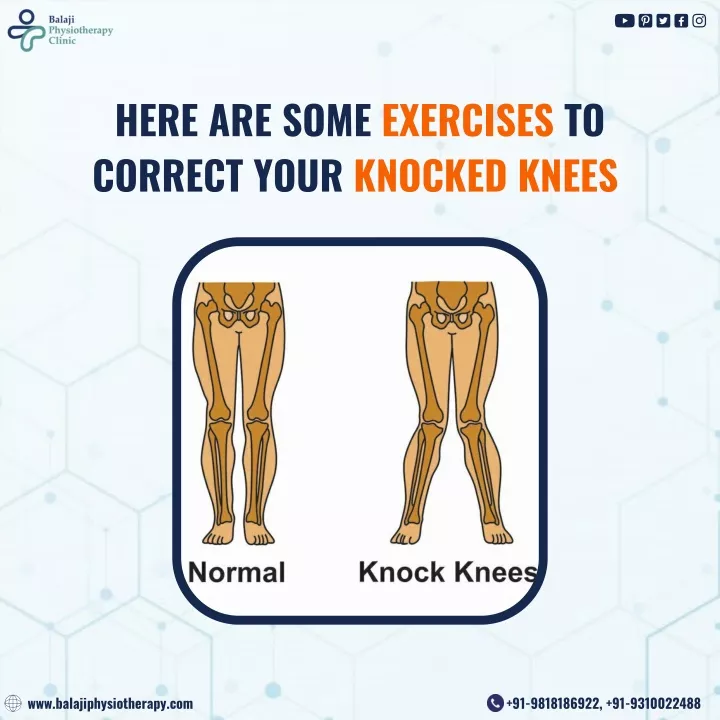 here are some exercises to correct your knocked