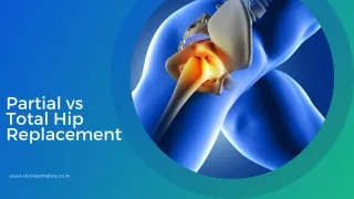 partial vs total hip replacement