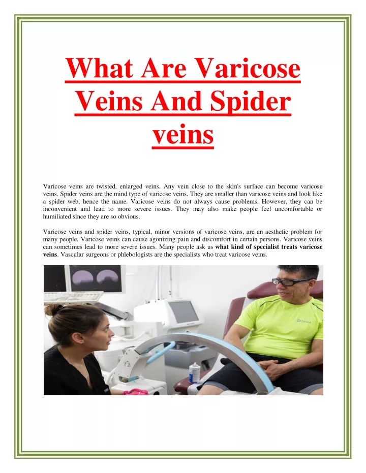 what are varicose veins and spider veins varicose