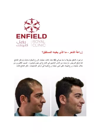 زراعة الشعر - ما الذي یخبئھ المستقبل؟
