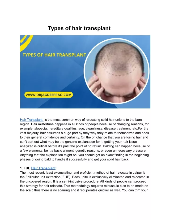 types of hair transplant