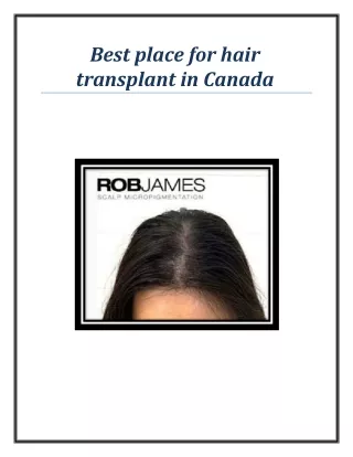 best place for hair transplant in canada
