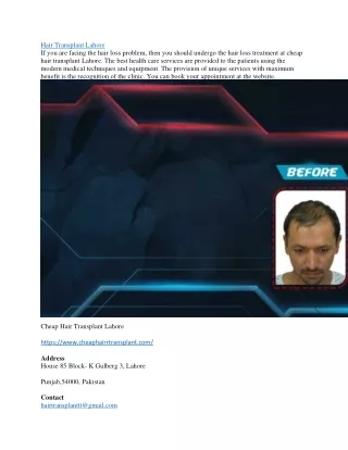 hair transplant lahore if you are facing the hair