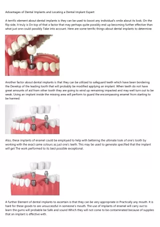 advantages of dental implants and locating