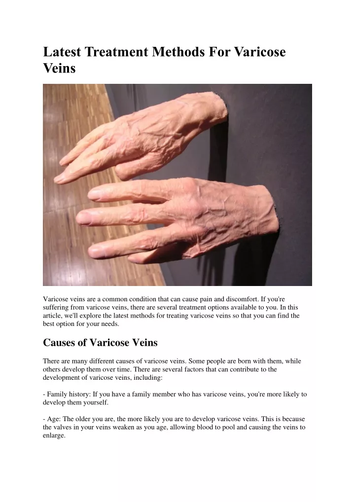latest treatment methods for varicose veins
