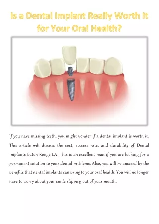 if you have missing teeth you might wonder