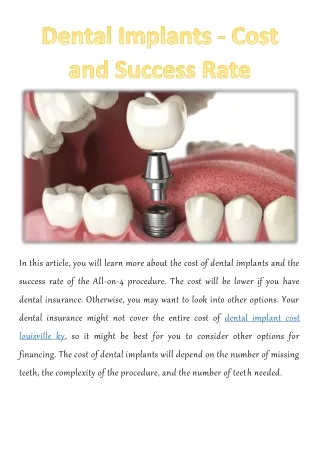 in this article you will learn more about