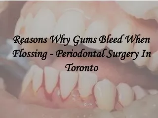 Reasons Why Gums Bleed When Flossing - Periodontal Surgery In Toronto
