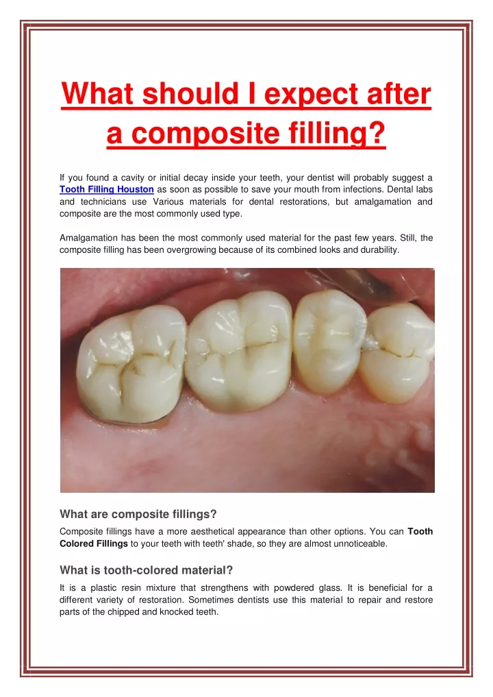 what should i expect after a composite filling