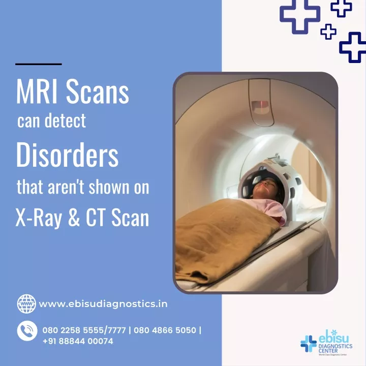 mri scans can detect disorders that aren t shown