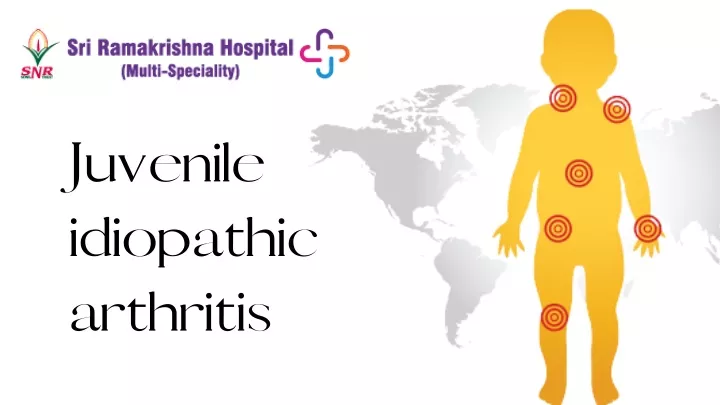 PPT - Juvenile idiopathic arthritis treatment in Coimbatore PowerPoint ...