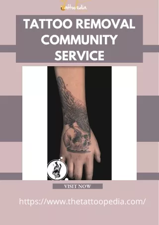 tattoo removal community service