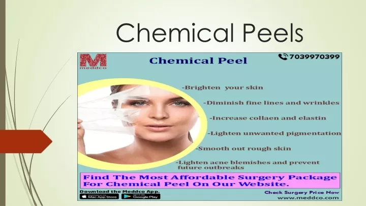 chemical peels