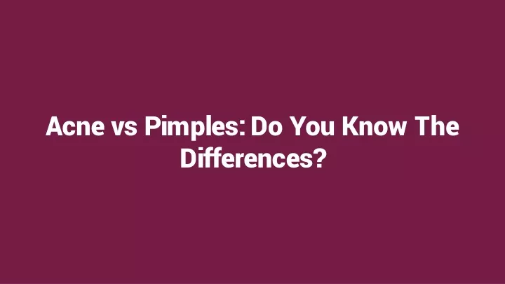 acne vs pimples do you know the differences