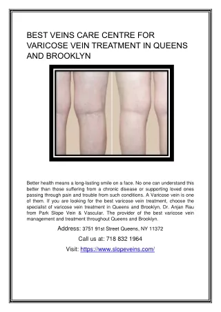 BEST VEINS CARE CENTRE FOR VARICOSE VEIN TREATMENT IN QUEENS AND BROOKLYN