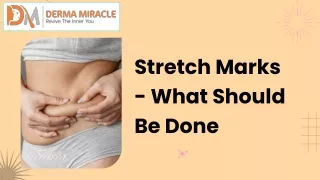 Stretch Marks - What Should Be Done