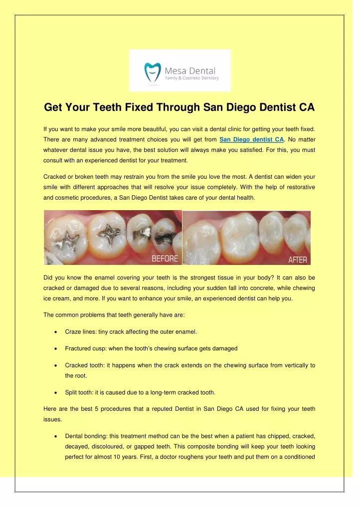 get your teeth fixed through san diego dentist ca