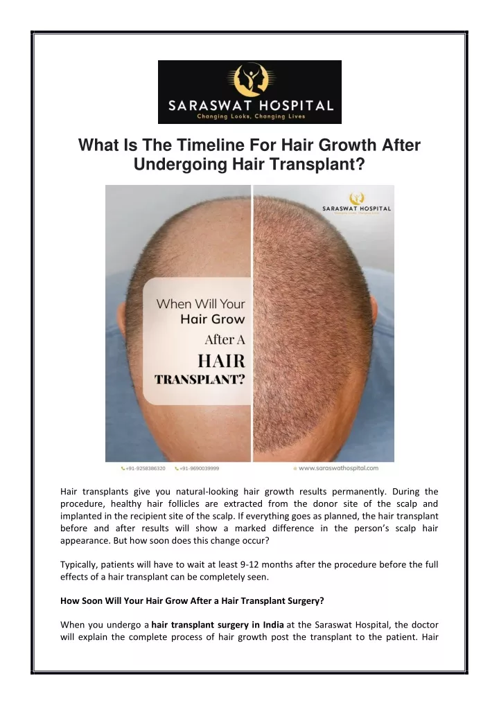 what is the timeline for hair growth after