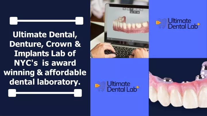 ultimate dental denture crown implants