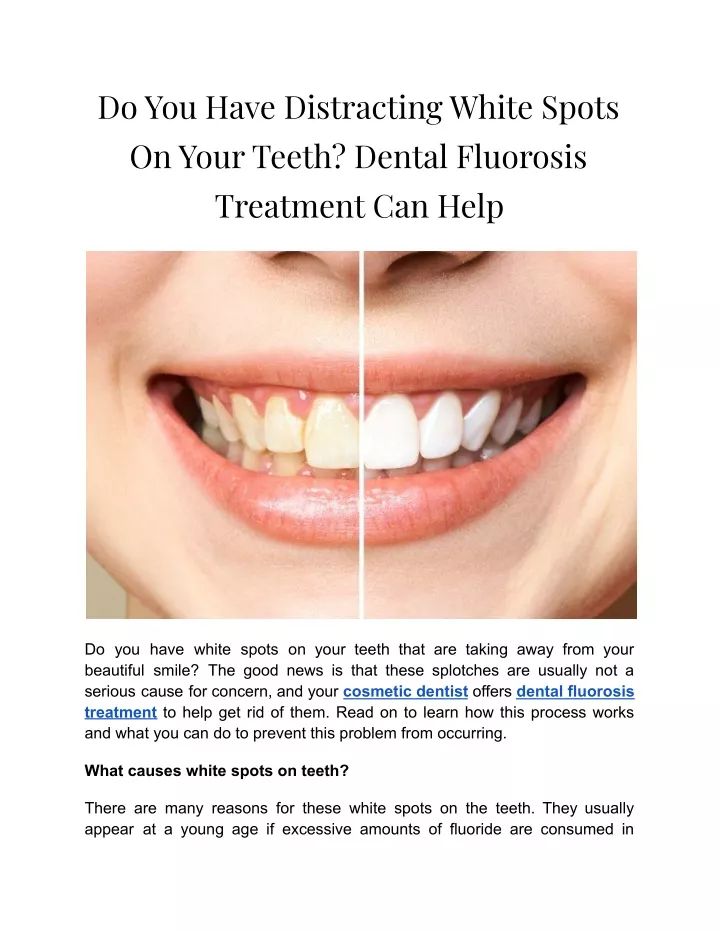 do you have distracting white spots on your teeth