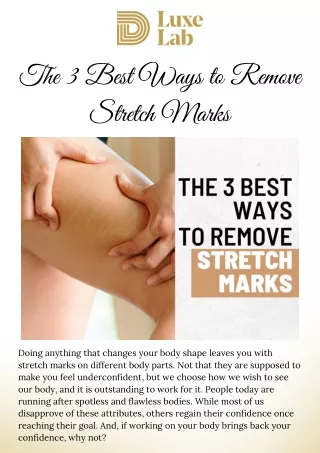 The 3 Best Ways to Remove Stretch Marks