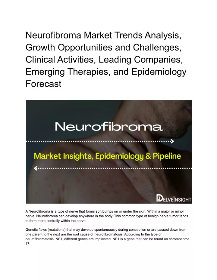 neurofibroma market trends analysis growth