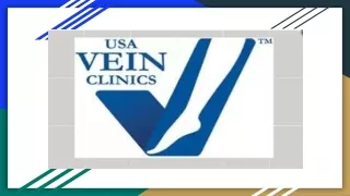 Varicose Vein Treatment