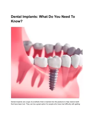 Dental Implants: What Do You Need To Know?