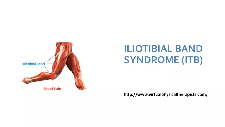 iliotibial band syndrome itb
