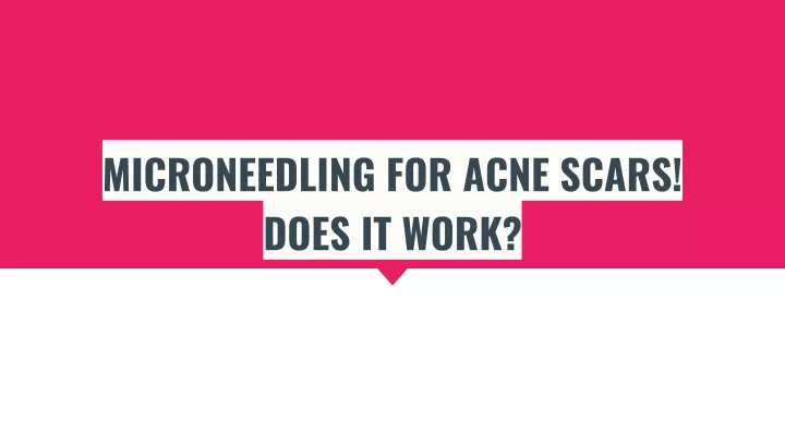 microneedling for acne scars does it work