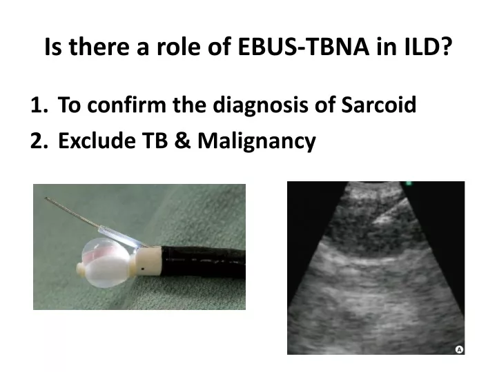 is there a role of ebus tbna in ild