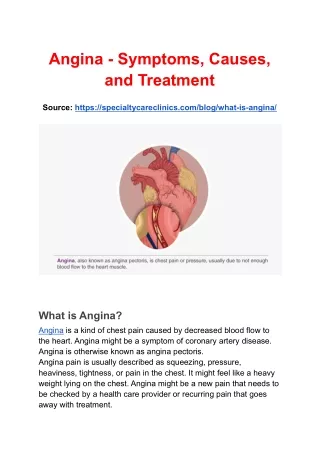 Angina - Symptoms, Causes, and Treatment