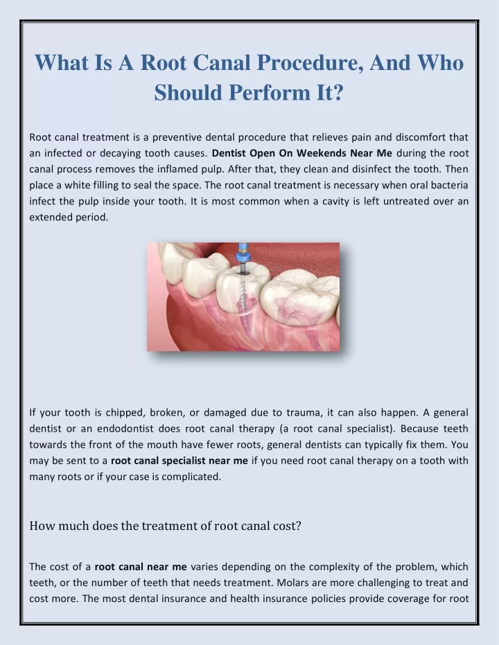 what is a root canal procedure and who should