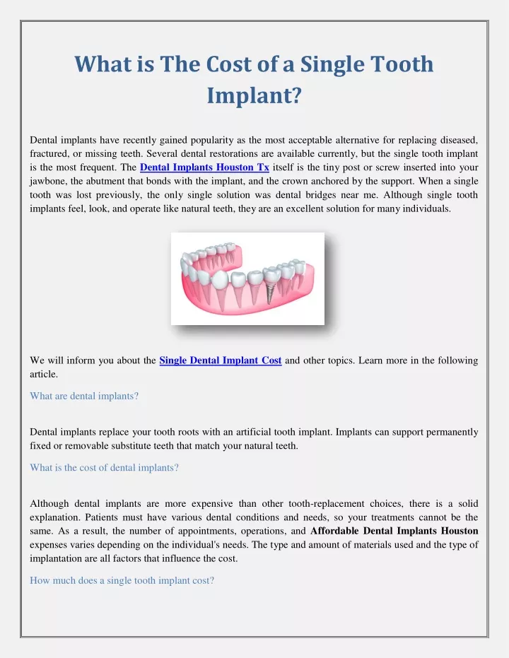 what is the cost of a single tooth implant