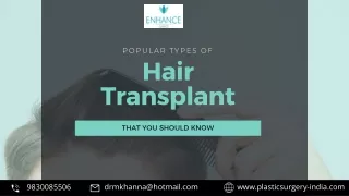 Popular Types of Hair Transplant that You Should Know