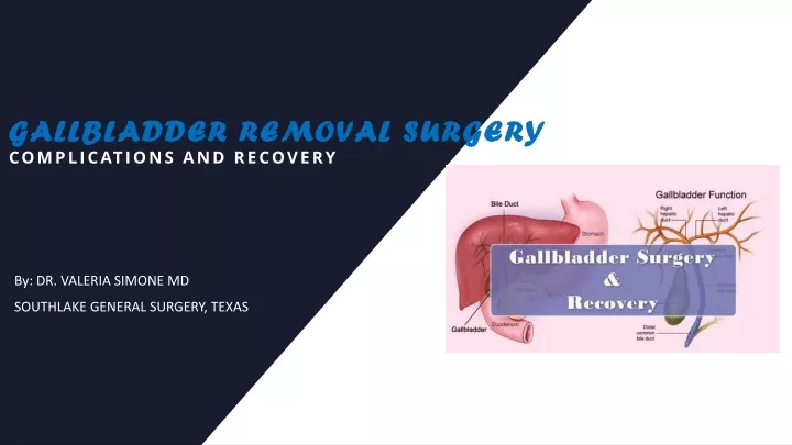 gallbladder removal surgery gallbladder removal