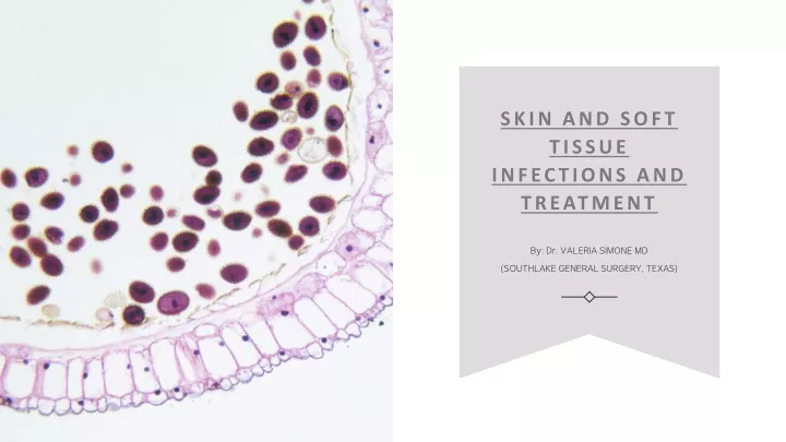 skin and soft tissue infections and treatment