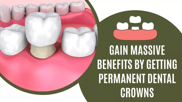 gain massive benefits by getting permanent dental