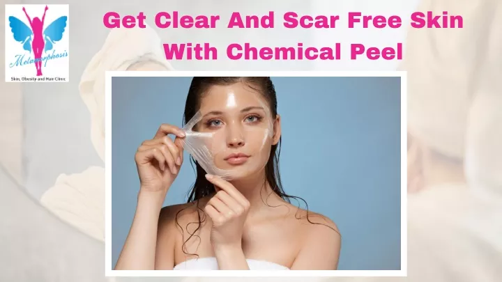 get clear and scar free skin with chemical peel