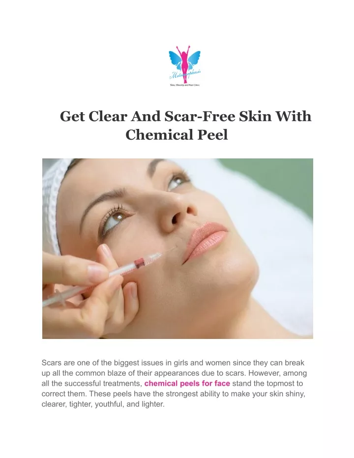 get clear and scar free skin with chemical peel