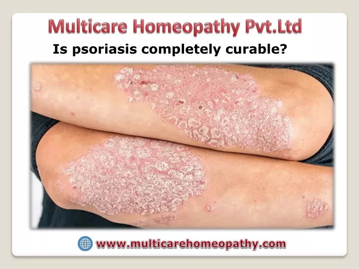 multicare homeopathy pvt ltd