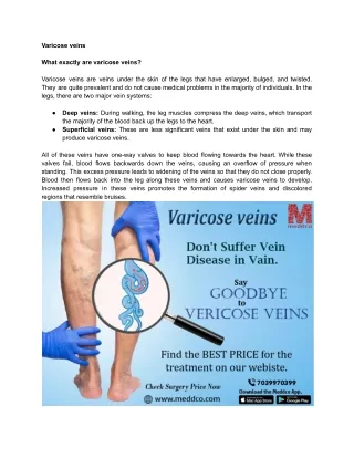 Varicose Veins