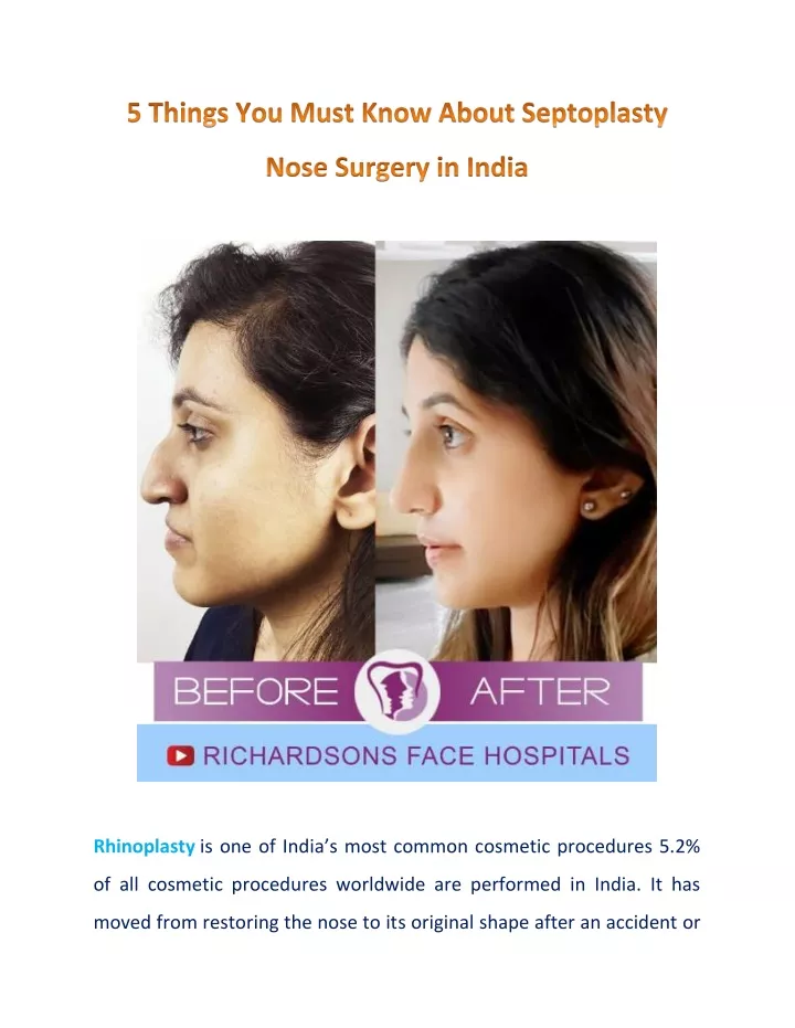 rhinoplasty is one of india s most common