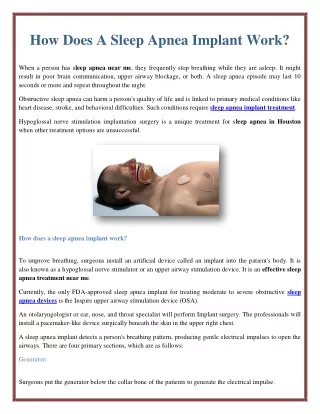 how does a sleep apnea implant work