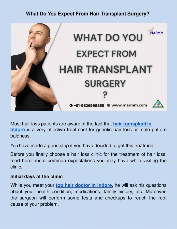 what do you expect from hair transplant surgery